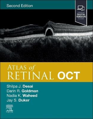Atlas of Retinal OCT by | Paper Plus
