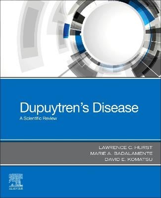 Dupuytren’S Disease: Review Of The Current Literature – LDAM