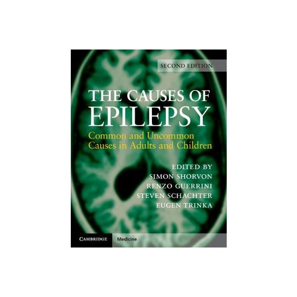 The Causes of Epilepsy -