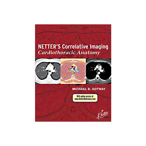 Netter's Correlative Imaging: Cardiothoracic Anatomy by Michael B ...