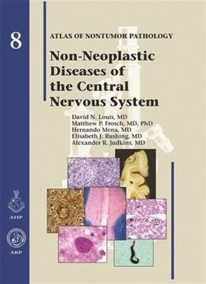 Non-Neoplastic Diseases of the Central Nervous System by David N. Louis ...