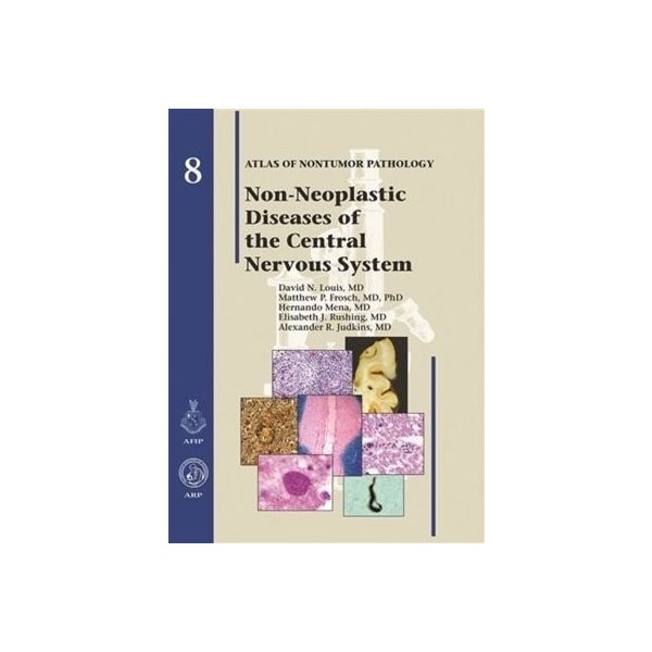 Non-Neoplastic Diseases of the Central Nervous System by David N. Louis ...