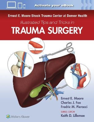 Ernest E. Moore Shock Trauma Center at Denver Health Illustrated Tips ...