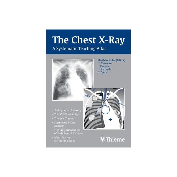 The Chest X-Ray -