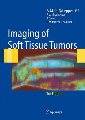 Imaging of Soft Tissue Tumors by | Paper Plus